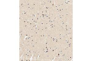 Immunohistochemical analysis of paraffin-embedded Human brain tissue using (ABIN651682 and ABIN2840359) performed on the Leica® BOND RXm. (USP17L24 antibody  (C-Term))