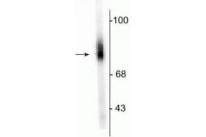 Western blot of human adrenal medulla lysate showing specific immunolabeling of the ~75 kDa DBH protein. (DBH antibody  (N-Term))
