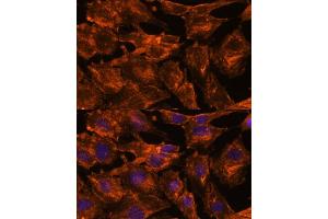 Immunofluorescence analysis of C6 cells using ITSN2 antibody (ABIN7268015) at dilution of 1:100. (Intersectin 2 antibody  (AA 500-620))