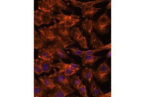 Immunofluorescence analysis of C6 cells using ITSN2 antibody (ABIN7268015) at dilution of 1:100. (Intersectin 2 antibody  (AA 500-620))