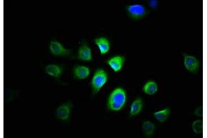 Immunofluorescence staining of A549 cells with ABIN7165056 at 1:166, counter-stained with DAPI. (PRMT1 antibody  (AA 1-248))
