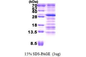SDS-PAGE (SDS) image for Ubiquitin-Conjugating Enzyme E2Z (UBE2Z) (AA 1-231) protein (His tag) (ABIN6387188)