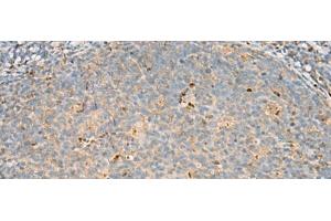 Immunohistochemistry of paraffin-embedded Human tonsil tissue using DNPEP Polyclonal Antibody at dilution of 1:60(x200) (Aspartyl Aminopeptidase antibody)