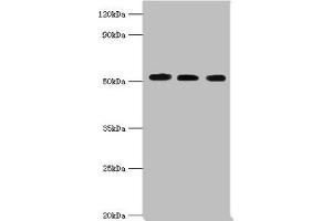 Western blot All lanes: Programmed cell death protein 4 antibody at 5 μg/mL Lane 1: Hela whole cell lysate Lane 2: MCF-7 whole cell lysate Lane 3: Jurkat whole cell lysate Secondary Goat polyclonal to rabbit IgG at 1/10000 dilution Predicted band size: 52, 51 kDa Observed band size: 52 kDa