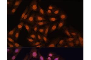 Immunofluorescence analysis of U-2 OS cells using CBX3 Polyclonal Antibody at dilution of 1:100. (CBX3 antibody)