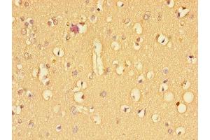 Immunohistochemistry of paraffin-embedded human brain tissue using ABIN7171961 at dilution of 1:100 (TGFBR2 antibody  (AA 25-159))