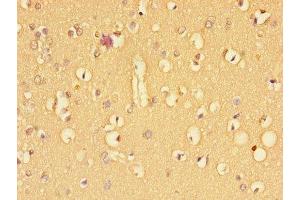 Immunohistochemistry of paraffin-embedded human brain tissue using ABIN7171961 at dilution of 1:100