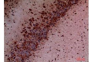 Immunohistochemistry (IHC) analysis of paraffin-embedded Mouse Brain, antibody was diluted at 1:100. (PIK3CD antibody  (Internal Region))