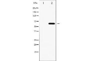 Western blot analysis of FRS2 phosphorylation expression in COS7 whole cell lysates,The lane on the left is treated with the antigen-specific peptide. (FRS2 antibody  (pTyr436))