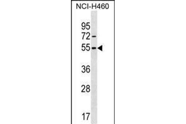 MIER1 Antikörper  (AA 214-242)