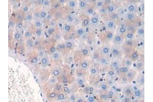 Detection of CD10 in Rat Liver Tissue using Polyclonal Antibody to Neprilysin (CD10)