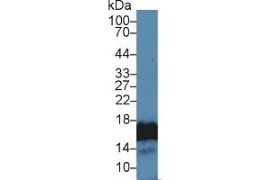 Detection of H3 in Human Lung lysate using Polyclonal Antibody to Histone H3 (H3) (Histone 3 antibody  (AA 1-136))