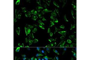 Immunofluorescence analysis of HeLa cells using TPM3 Polyclonal Antibody (TPM3 antibody)