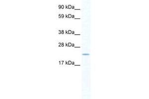 Western Blotting (WB) image for anti-SERTA Domain Containing 1 (SERTAD1) antibody (ABIN2460913) (SERTAD1 antibody)
