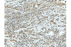 IHC analysis of FHL2 using anti-FHL2 antibody (ABIN7600782). (FHL2 antibody  (AA 234-279))