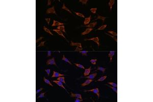 Immunofluorescence analysis of L929 cells using RPS17 antibody (ABIN7270016) at dilution of 1:100. (RPS17 antibody  (AA 1-100))
