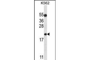 BAX Antibody (N-term) (ABIN657135 and ABIN2846276) western blot analysis in K562 cell line lysates (35 μg/lane). (BAX antibody  (N-Term))