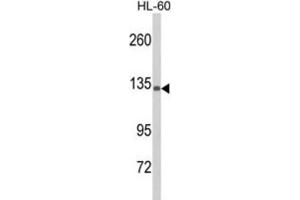 Western Blotting (WB) image for anti-Complement Component 5 (C5) antibody (ABIN3003812) (C5 antibody)