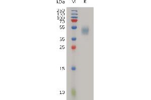 Human PLAUR Protein, His Tag on SDS-PAGE under reducing condition. (PLAUR Protein (AA 23-303) (His tag))