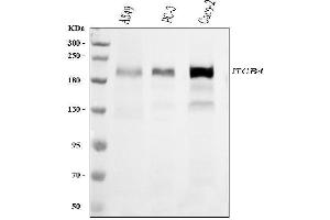 Western blot analysis of ITGB4 using anti-ITGB4 antibody (ABIN7601134).