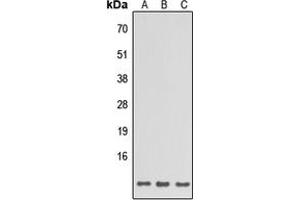 Western blot analysis of SPINK6 expression in HeLa (A), Raw264. (SPINK6 antibody  (Center))