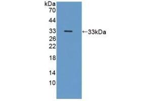 Detection of Recombinant ICAM3, Human using Polyclonal Antibody to Intercellular Adhesion Molecule 3 (ICAM3) (ICAM-3/CD50 antibody  (AA 259-491))