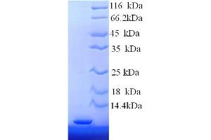 SDS-PAGE (SDS) image for Metallothionein 2 (MT2) (AA 1-59), (partial) protein (His tag) (ABIN5713676) (MT2 Protein (AA 1-59, partial) (His tag))