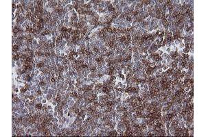 Immunohistochemistry (IHC) image for anti-T-cell surface glycoprotein CD1c (CD1C) antibody (ABIN2670667) (CD1c antibody)