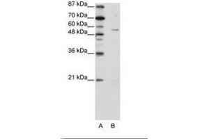 Image no. 1 for anti-Zinc Finger Protein 329 (ZNF329) (N-Term) antibody (ABIN202735) (ZNF329 antibody  (N-Term))