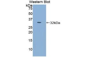 Detection of Recombinant CDH16, Mouse using Polyclonal Antibody to Cadherin 16 (CDH16)