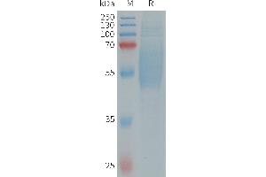 SDS-PAGE (SDS) image for Interleukin 1 Receptor-Like 2 (IL1RL2) (AA 20-335) protein (His tag) (ABIN7538338)