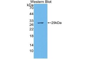 Detection of Recombinant PCX, Mouse using Polyclonal Antibody to Podocalyxin (PODXL) (PODXL antibody  (AA 171-404))