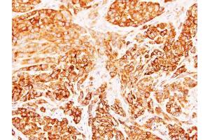 IHC-P Image Immunohistochemical analysis of paraffin-embedded A549 xenograft, using Diablo, antibody at 1:500 dilution. (DIABLO antibody)