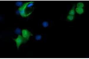 Image no. 2 for anti-Peptidyl Arginine Deiminase, Type IV (PADI4) (AA 299-588) antibody (ABIN1491356) (PAD4 antibody  (AA 299-588))