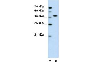WB Suggested Anti-SOX11 Antibody Titration:  0. (SOX11 antibody  (N-Term))