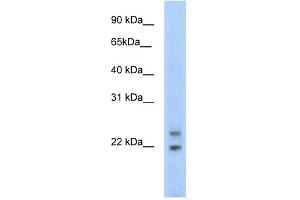 C330003B14RIK antibody (20R-1169) used at 0.