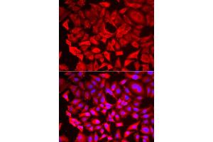 Immunofluorescence analysis of HeLa cell using SRP19 antibody. (SRP19 antibody)
