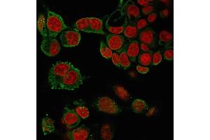 Immunofluorescence staining of paraformaldehyde-fixed HePG2 cells with TNF alpha Mouse Monoclonal Antibody (4C6-H8) followed by goat anti-Mouse IgG-CF488 (Green). (TNF alpha antibody  (AA 115-130))