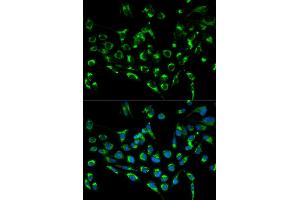 Immunofluorescence analysis of MCF-7 cells using CDKN3 antibody.