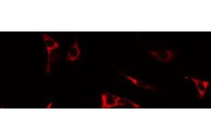 ABIN6274673 staining LOVO by IF/ICC. (IL17RA antibody  (N-Term))