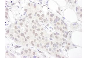 Immunohistochemistry (IHC) image for anti-Small Nuclear Ribonucleoprotein D3 Polypeptide 18kDa (SNRPD3) (AA 1-50) antibody (ABIN7454572)