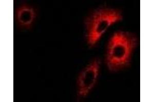 Immunofluorescent analysis of PCCB staining in U2OS cells. (PCCB antibody)