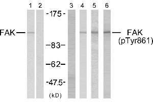Western blot analysis using FAK (Ab-861) antibody (Line 1 and 2) and FAK (phospho-Tyr861) antibody (Line 3, 4, 5 and 6). (FAK antibody  (pTyr861))