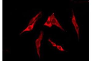 ABIN6276220 staining Hela by IF/ICC. (TAS2R13 antibody  (Internal Region))