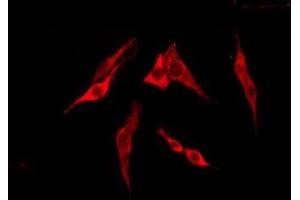TAS2R13 antibody  (Internal Region)