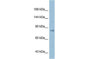 WB Suggested Anti-KPNB1 AntibodyTitration: 1. (KPNB1 antibody  (N-Term))
