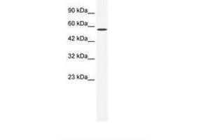 Image no. 1 for anti-Zinc Finger and BTB Domain Containing 44 (ZBTB44) (AA 221-270) antibody (ABIN6735970) (ZBTB44 antibody  (AA 221-270))
