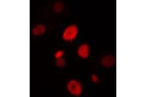 ABIN6274428 staining HuvEc cells by IF/ICC. (HIPK4 antibody  (C-Term))