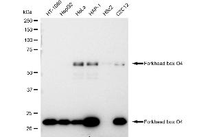 Western blotting analysis using Forkhead box O4 antibody (ABIN7798648).