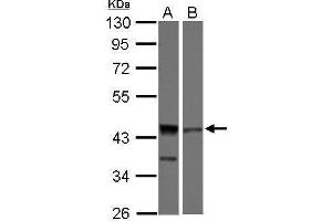 WB Image Sample (30 ug of whole cell lysate) A: 293T B: Jurkat 10% SDS PAGE antibody diluted at 1:1000 (DFFA antibody)